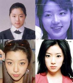 明星整容失败前后照片,失败案例警示录