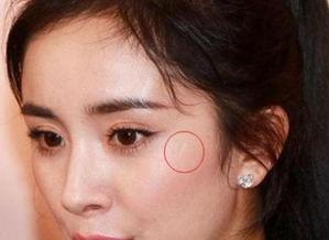 明星开颅疤痕图,开颅疤痕背后的故事